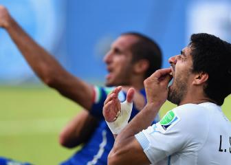Chiellini says he understands Suárez bite: