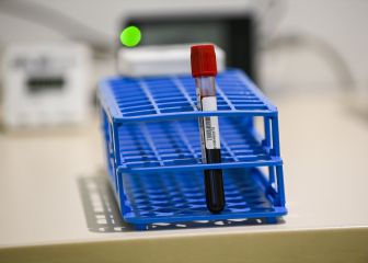 Blood type might affect covid-19 infection: how and what types?