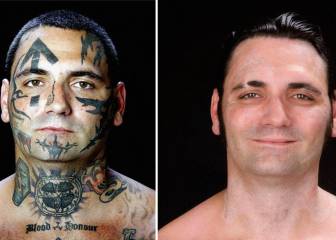 Un año y medio para eliminar sus tatuajes: la dura historia de un exneonazi