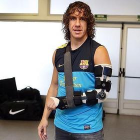 Puyol mejora de su luxación de codo y ya no lleva escayola Puyol mejora de su luxación de codo y ya no lleva escayola