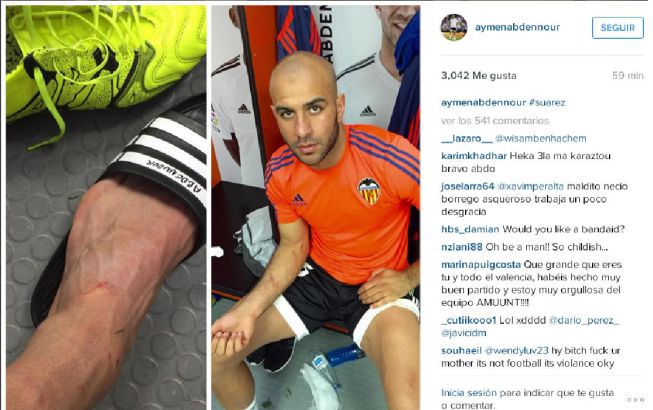 As qued el pie de Abdennour tras el pisotn de Luis Surez