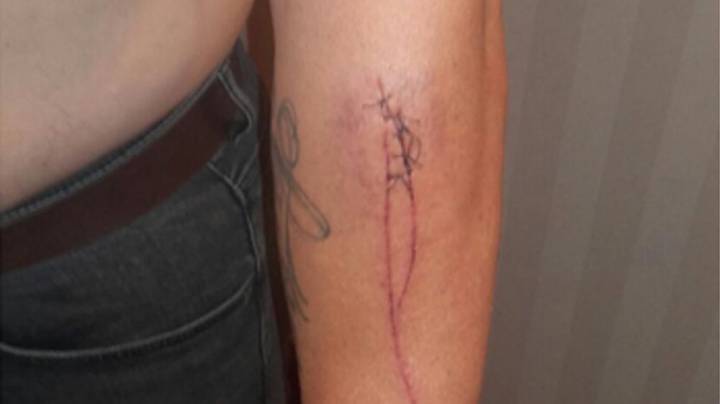 Match-fixing whistleblower attacked in Granada public park