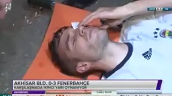 Van Persie could have lost eye after suffering horrific injury