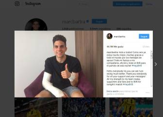 Bartra, operado de la fractura de muñeca: