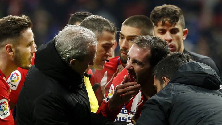 Los defensas de Simeone suman 195 días de baja