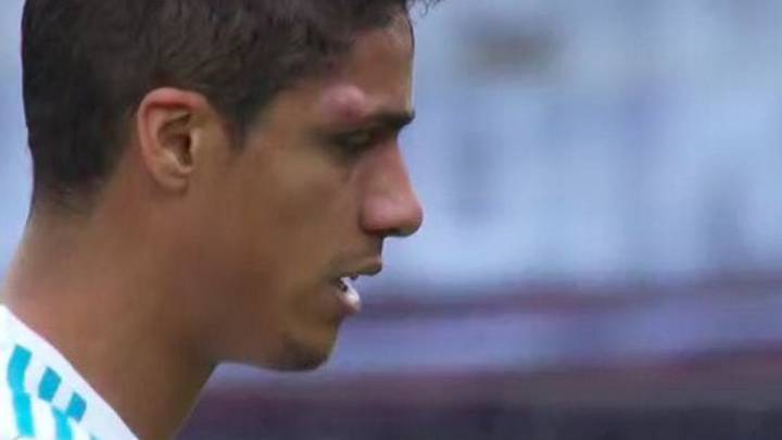 Eibar 1-2 Real Madrid: Varane forced off with head injury