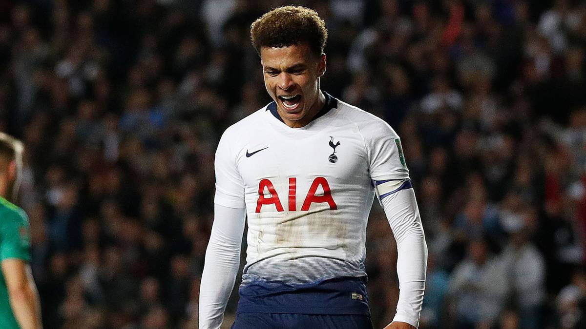 Pochettino pierde a Dele Alli, recupera a Erikssen y tiene en duda a Vertonghen y Lloris