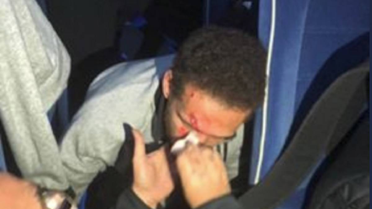 El autobús del Al-Ahly atacado antes de la final: hay un herido