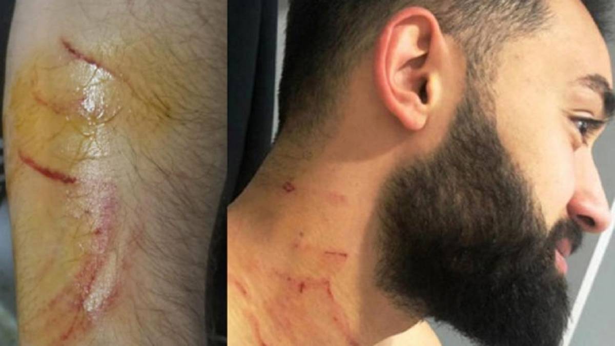 Çalar agredió con una cuchilla a los futbolistas del Sakaryaspor.