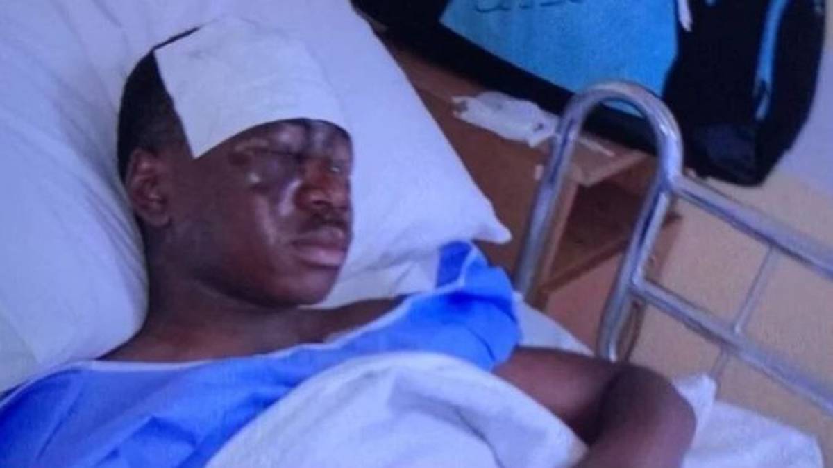 Tega Agberhiere, cegado por un ataque con ácido