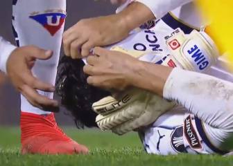 Toda La Bombonera se tapó la cara: terrible triple fractura por evitar un gol de Tévez