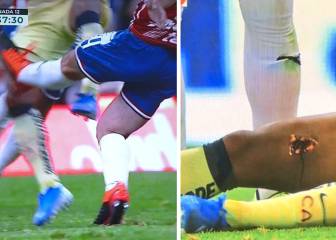 No apto para sensibles: Gio dos Santos y la peor entrada...