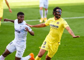Albiol: