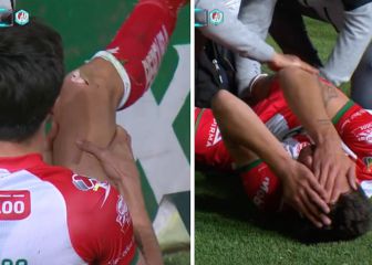 No apto para sensibles: la increíble lesión que vivió un jugador del Necaxa...