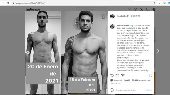 El central del Betis Marc Bartra reveló en las redes sociales que ha sufrido un problema de vesícula y pérdida de peso durante el último mes.