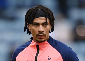 Dele Alli se queda sin Eurocopa
