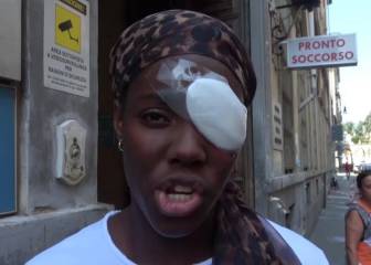 Daisy Osakue, herida con huevos en un posible ataque racista