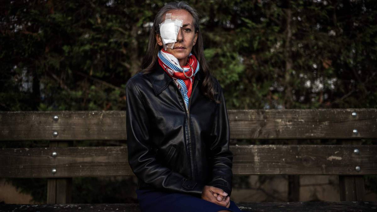 Corine Remande, la mujer que perdió la visión de su ojo derecho tras un bolazo de Brooks Koepka en la Ryder Cup, posa tras salir del hospital.