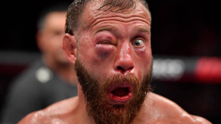Donald Cerrone no se lesionó en el UFC 238.