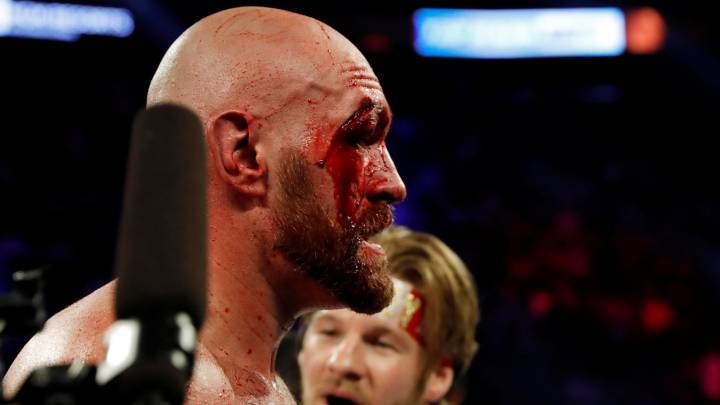 Fury se lleva 47 puntos de sutura de su combate con Wallin