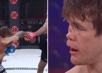 La brutal patada que hundió la nariz de su rival: la última imagen impresiona mucho