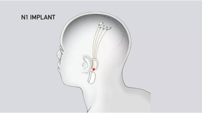neuralink