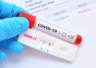 6000 tests PCR del Coronavirus al día en Madrid con estos nuevos robots