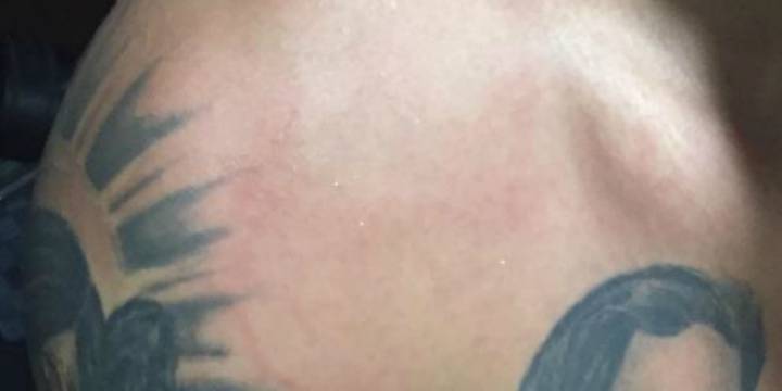 ¿La prueba de que no era penal? Así se ve el hombro de Samudio