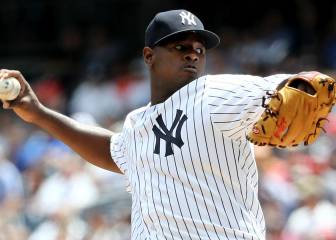 Severino no volvería a los Yankees hasta, al menos, julio