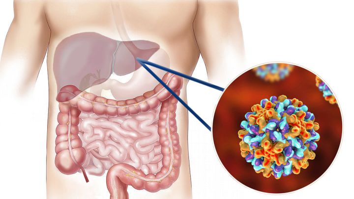 Día Mundial contra la Hepatitis: diferencias entre la A, B y C