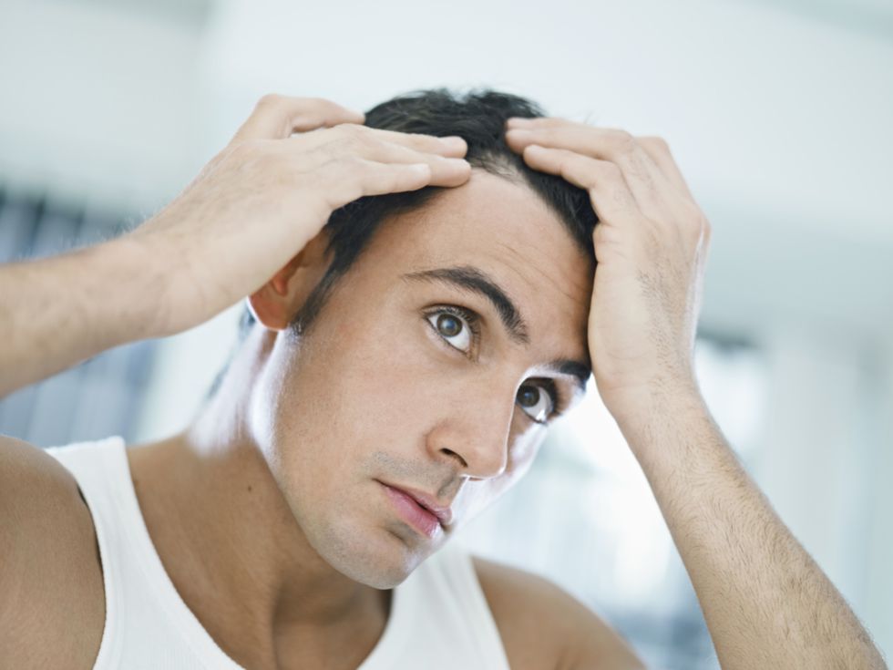 ¿Se te cae el pelo? Causas y tratamientos para la Alopecia