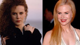 Nicole Kidman antes y después