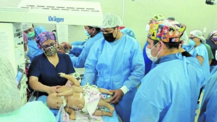 Separan a bebés siameses en Arequipa tras una larga y curiosa intervención