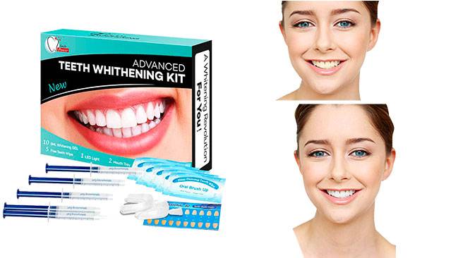 kit de blanqueamiento dental