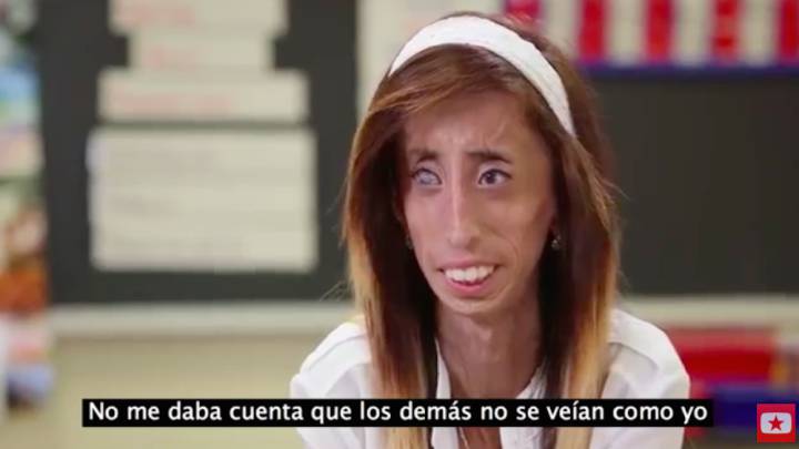 Estrenan el documental de “La mujer más fea del mundo”