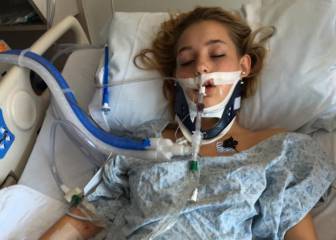 Publica las fotos de su hija en coma para concienciar de los peligros del alcohol