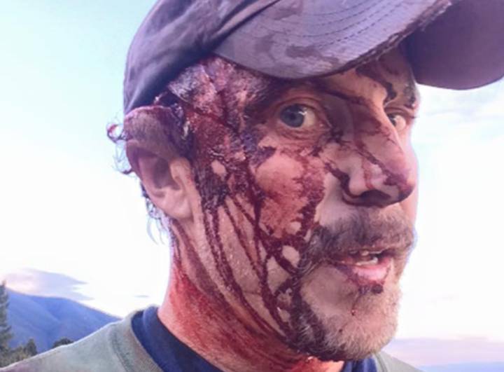 Un hombre se graba después de ser atacado por un oso