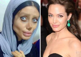 Una iraní se 'estrella' al intentar parecerse a Angelina Jolie