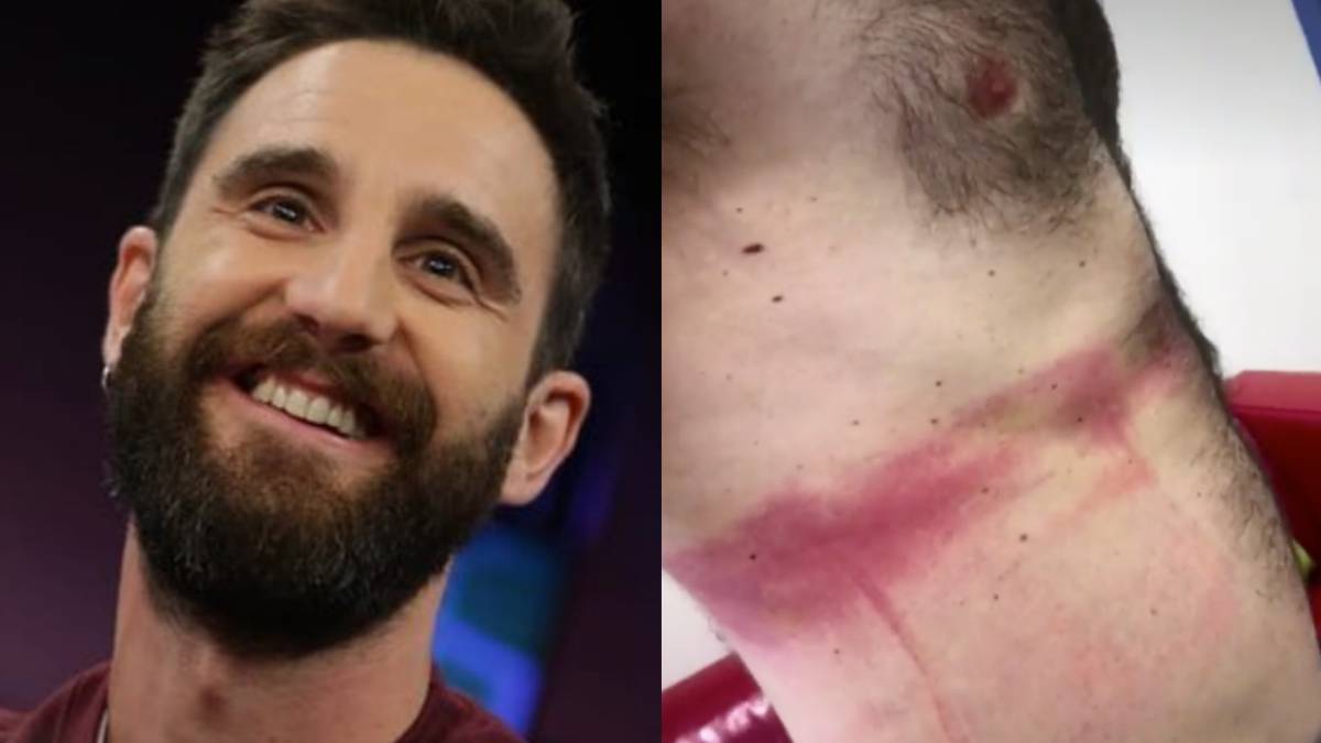 Dani Rovira en El Hormiguero con su cuerpo tras rodar Superlópez.