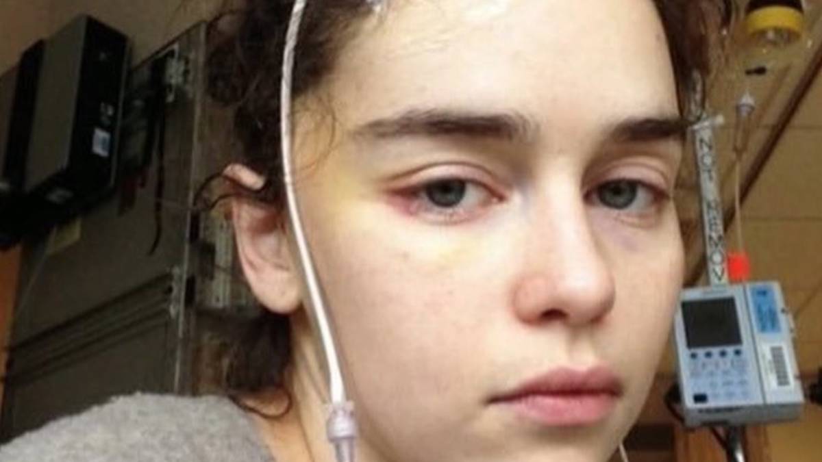 Las inquietantes fotos de Emilia Clarke recuperándose de sus operaciones cerebrales