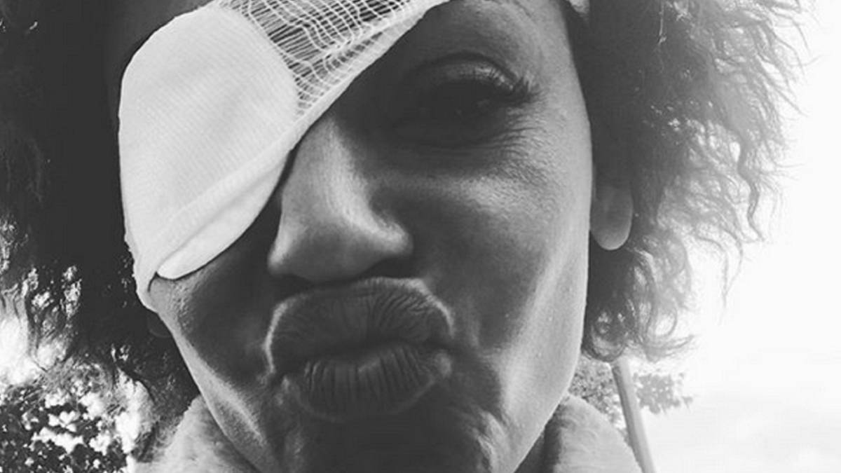 Mel B aclara su situación tras quedarse ciega de un ojo y ver borroso con el otro