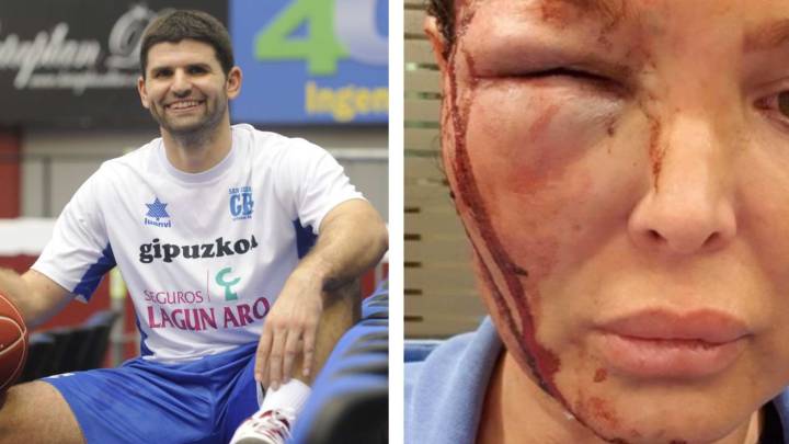 La expareja de Papamakarios, exjugador ACB, denuncia sus supuestas palizas