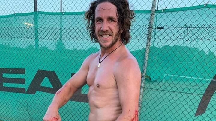 Puyol acaba ensangrentado tras un accidente jugando al pádel