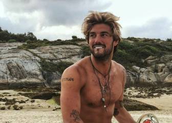Así ha quedado el ojo de Logan tras su grave accidente