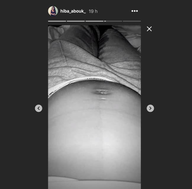 hiba abouk patada embarazo