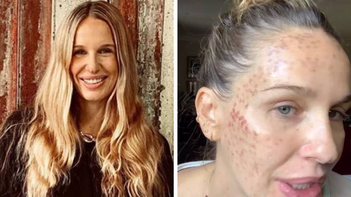 carola baleztena tratamiento facial