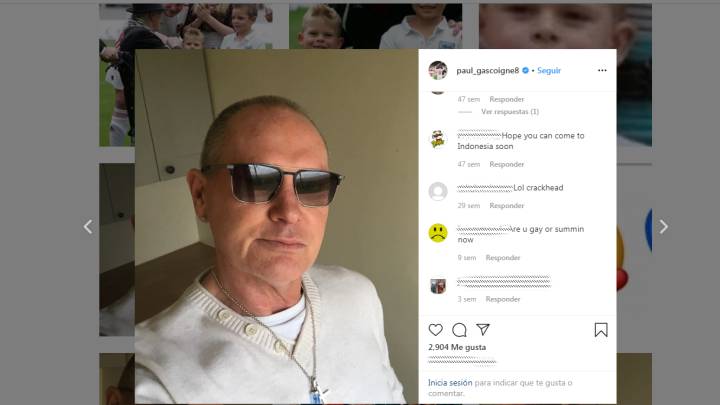 Gascoigne spent €24k on stomach pellet op to give up drinking