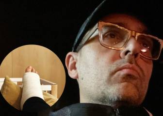 Risto Mejide explica el verdadero motivo de su lesión