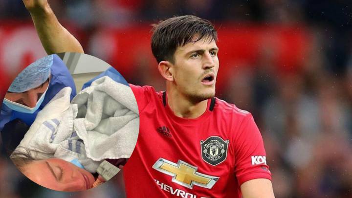 harry maguire padre nueve meses después fichaje manchester united 85 millones defensa mas caro
