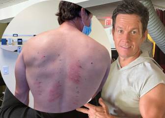 El actor Mark Wahlberg descubre a sus 49 años que es alérgico a